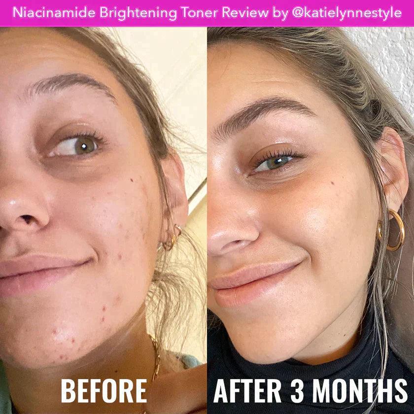 Good Molecules Niacinamide Brightening Toner 120ml - Astrid & Rose