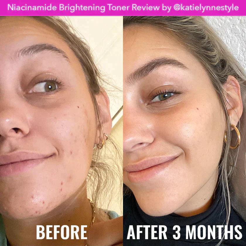 Good Molecules Niacinamide Brightening Toner 120ml - Astrid & Rose