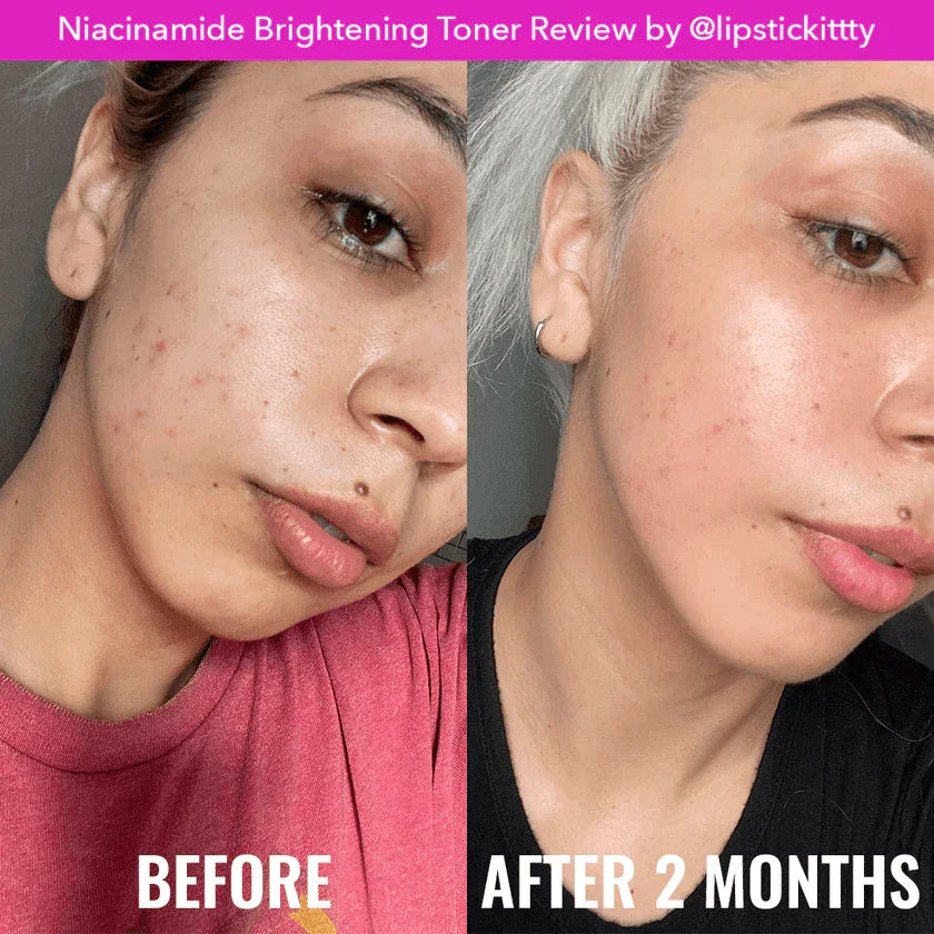 Good Molecules Niacinamide Brightening Toner 30ml Travel Size - Astrid & Rose