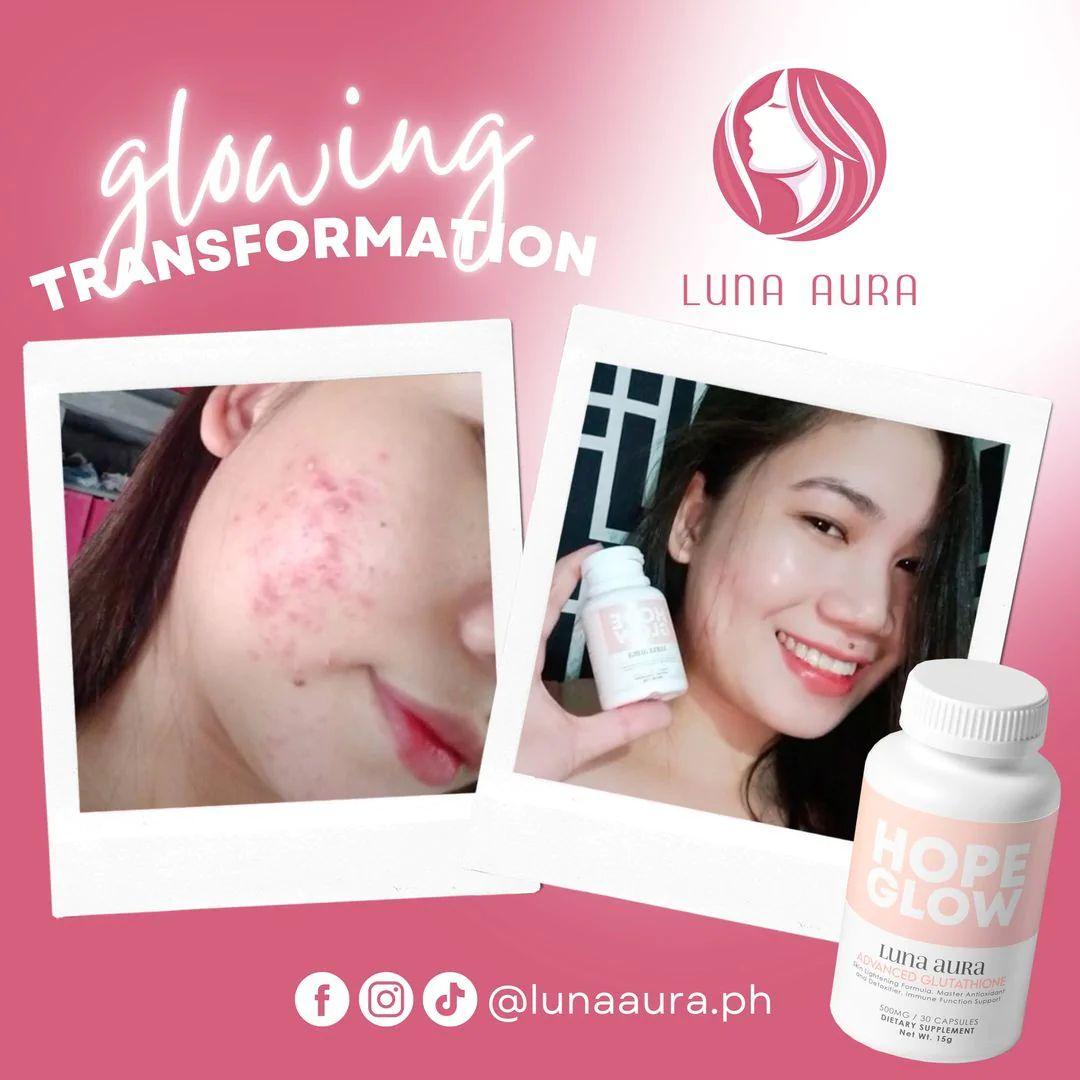 Luna Aura Hope Glow (PREORDER) - Astrid & Rose