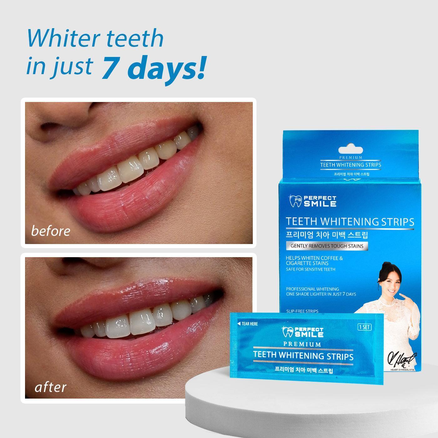 Perfect Smile Teeth Whitening Strips 8pcs - Astrid & Rose