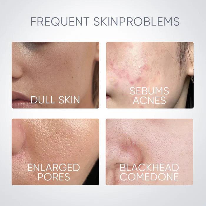 Skintific Alaska Volcano Reduce Blackheads Deep Pores Cleansing Clay Mask Stick 40g - Astrid & Rose