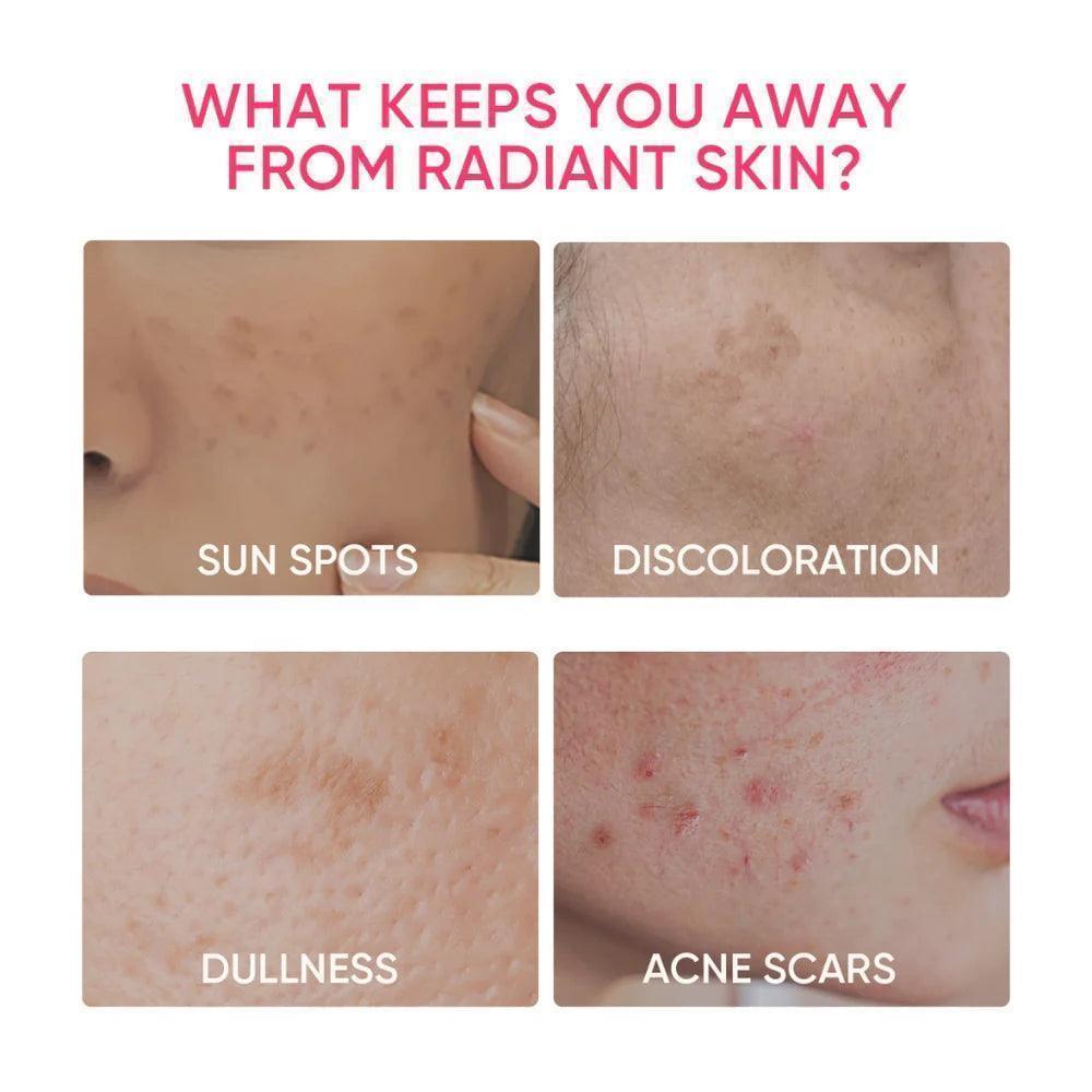 Skintific MSH Niacinamide Whitening Moisturizer - Astrid & Rose