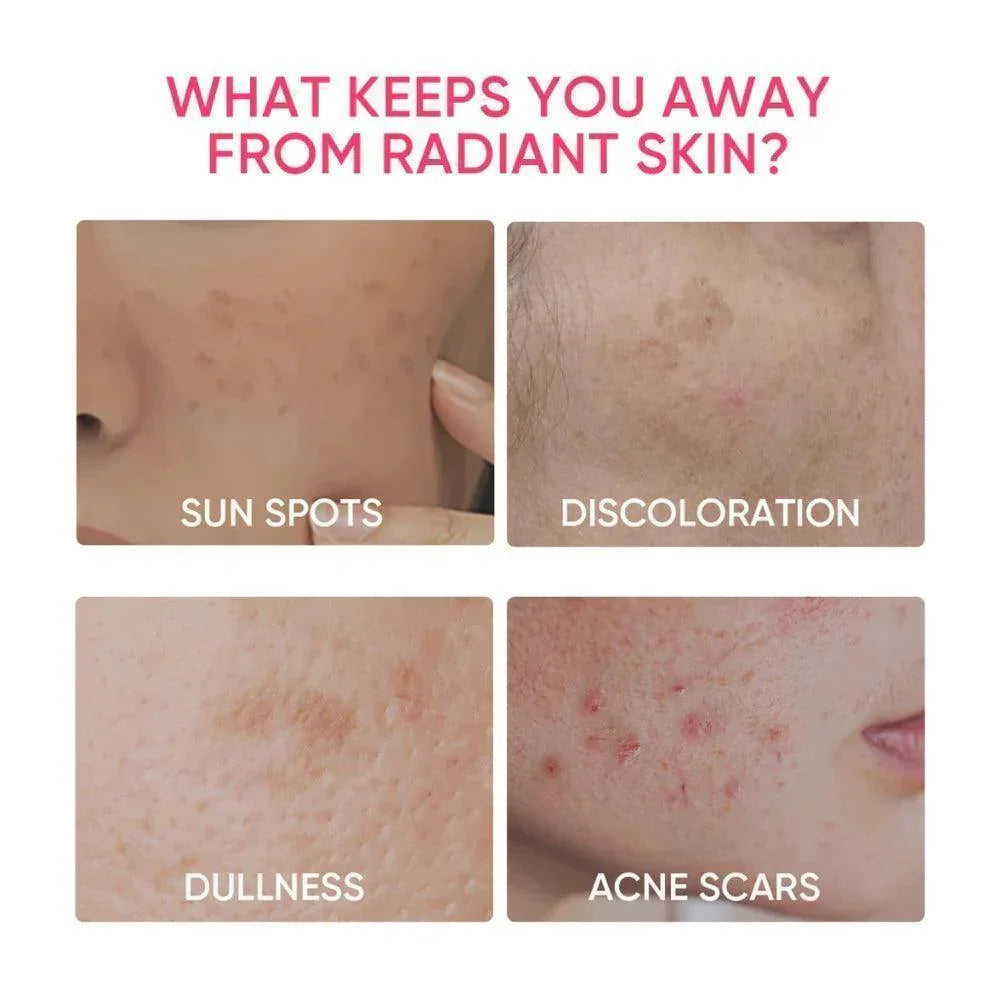 Skintific MSH Niacinamide Whitening Moisturizer - Astrid & Rose