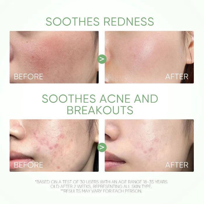 Skintific Mugwort Acne Clay Mask Stick 40g - Astrid & Rose