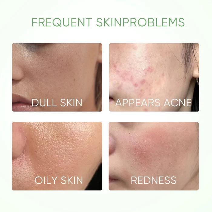 Skintific Mugwort Acne Clay Mask Stick 40g - Astrid & Rose