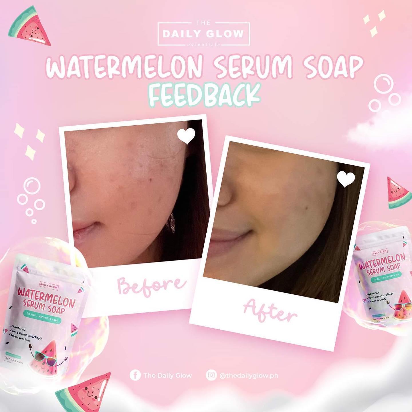 The Daily Glow Watermelon Serum Soap - Astrid & Rose