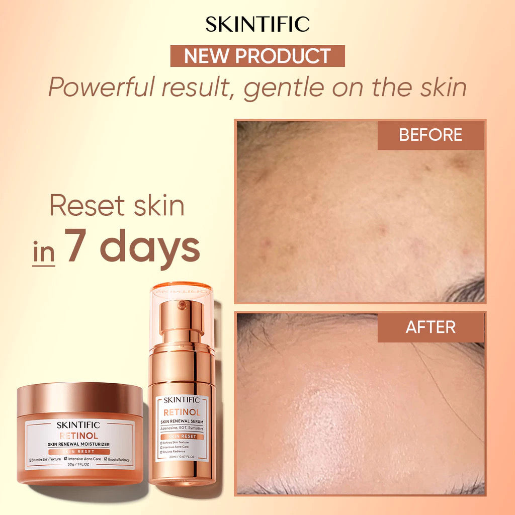 Skintific Retinol Skin Renewal Moisturizer