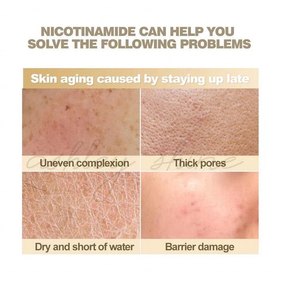 Ashley Shine Niacinamide Pure Serum 2 in 1 Face & Body 520ml - Astrid & Rose
