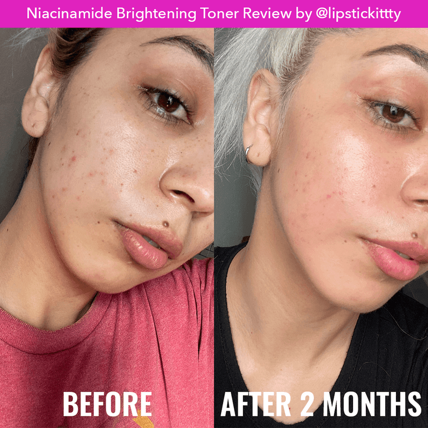 Good Molecules Niacinamide Brightening Toner 30ml Travel Size - Astrid & Rose