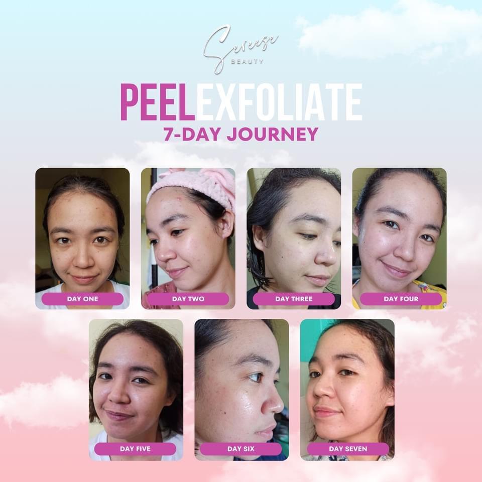 Sereese Beauty Peel Exfoliate Skincare - Astrid & Rose