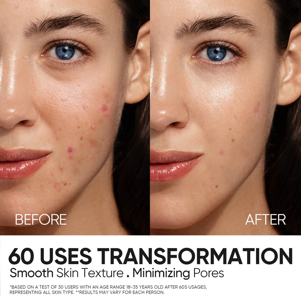 Skintific 12% AHA BHA PHA LHA Peeling Solution Serum