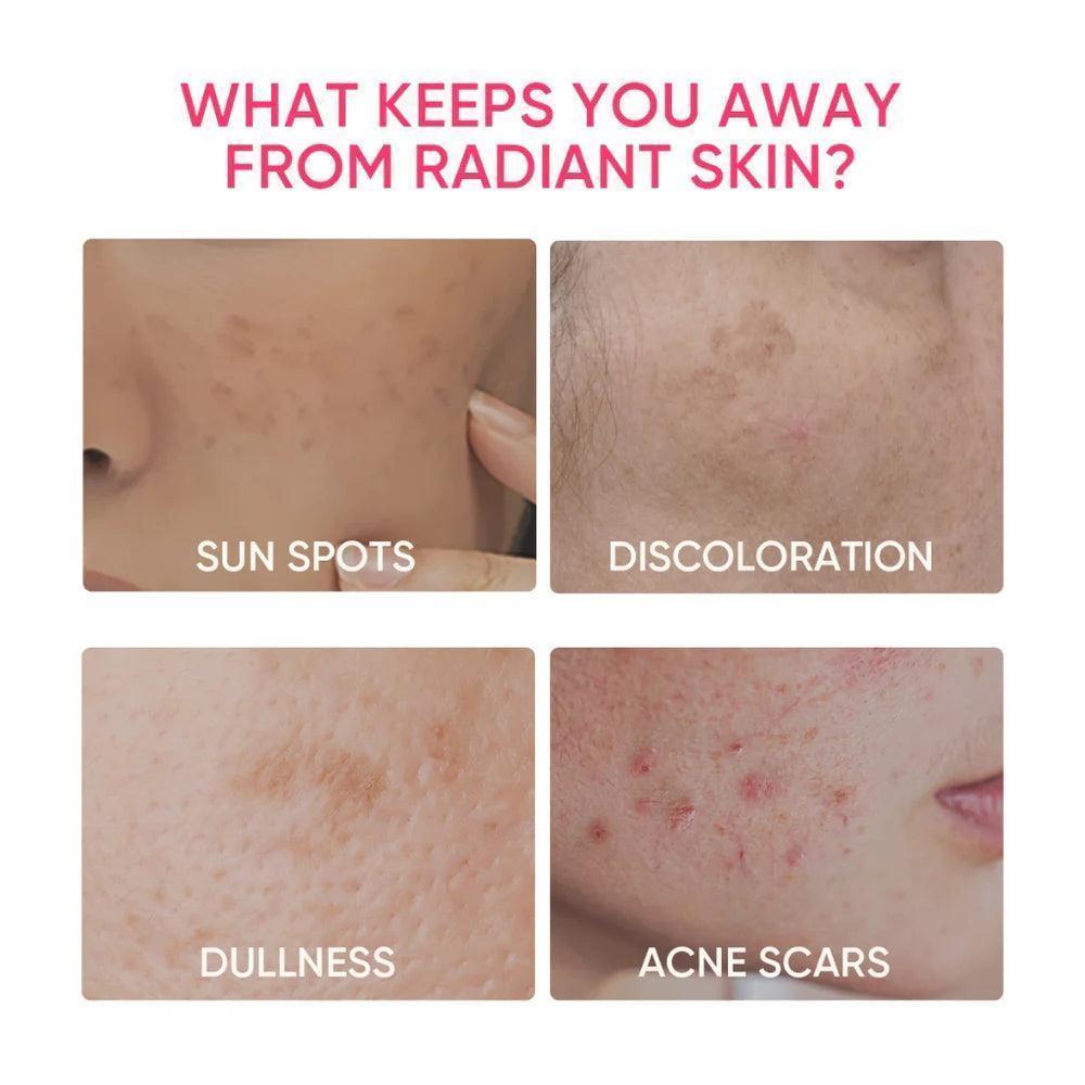 Skintific MSH Niacinamide Whitening Moisturizer - Astrid & Rose