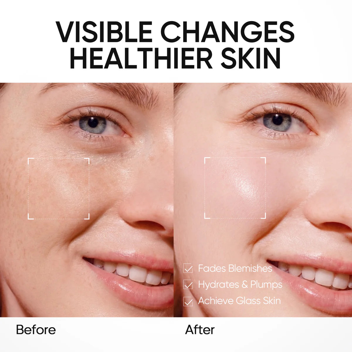 Skintific PDRN Bright & Smooth Moisture Gel Cream Moisturizer